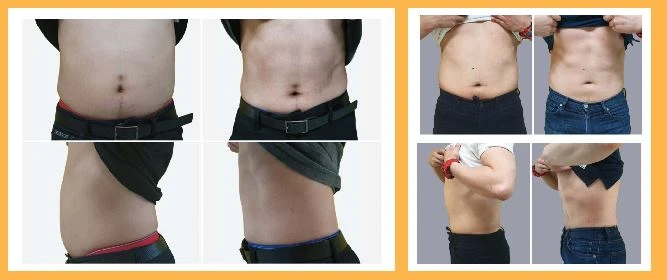emsculpt machine price emsculpt machine price